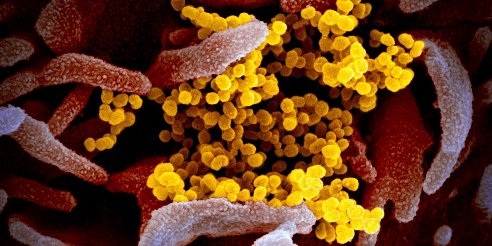 Cik sver viss pasaules koronavīruss? 5 savdabīgas lietas, ko pērn izskaitļoja zinātnieki