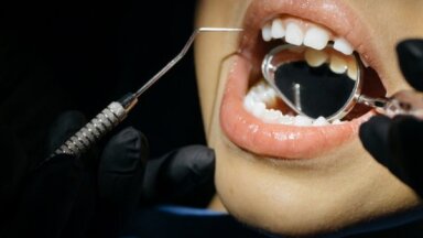 Speciālista padomi, kā pārvarēt bailes no zobārsta