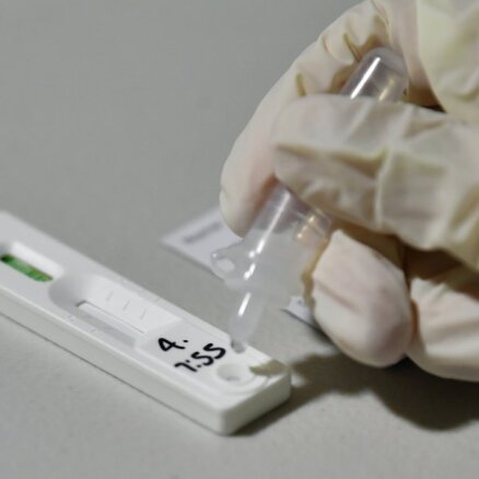 Latvijas iestādēm piegādātie Covid-19 antigēnu testi atbilst prasībām, uzsver AM