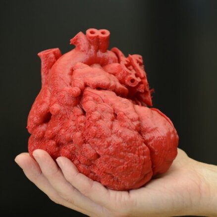 Slimu bērnu glābj ar 3D printeri izdrukāta sirds