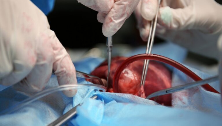 "Самая экстремальная трансплантация в истории". В больнице Страдиня состоялась первая в этом году пересадка сердца